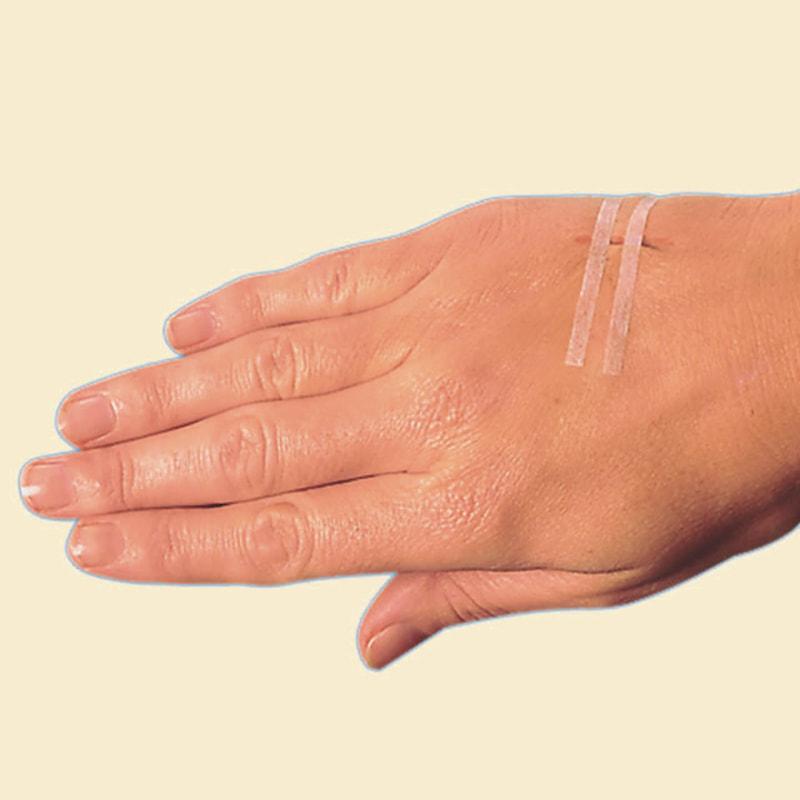 Banda de închidere a pielii